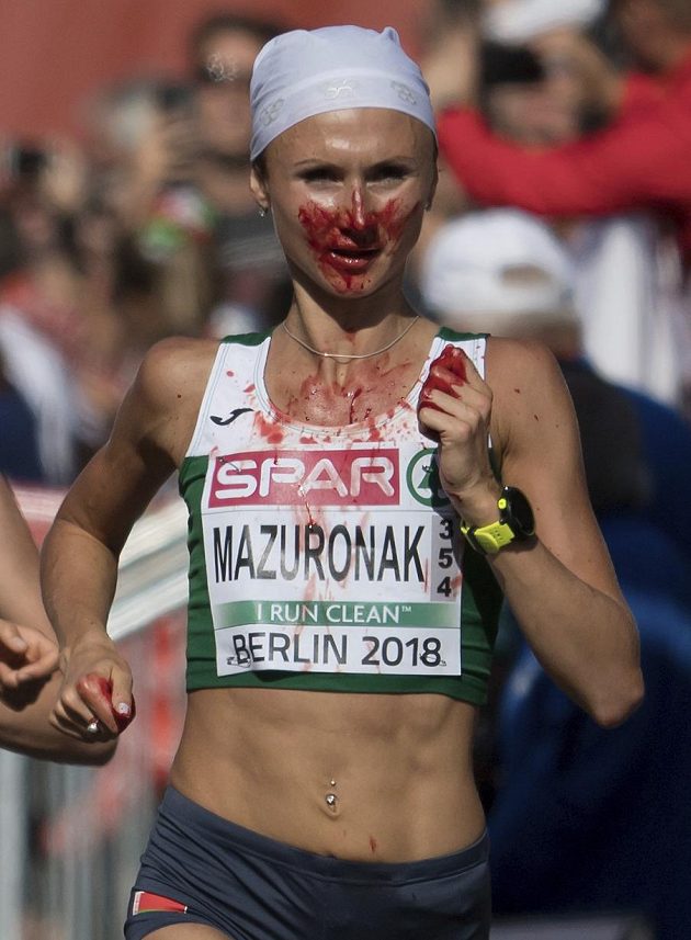 Běloruska Volha Mazuronaková vyhrála maratón na mistrovství Evropy, přestože se během závodu potýkala s velmi silným krvácením z nosu.