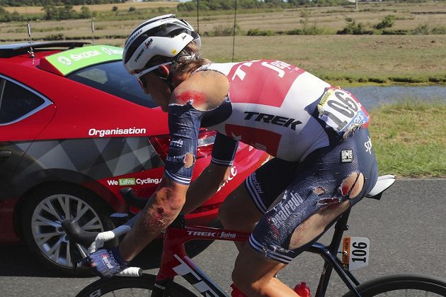 Lotyšský cyklista Toms Skujins skončil v úterý na Tour de France pořádně potlučený.