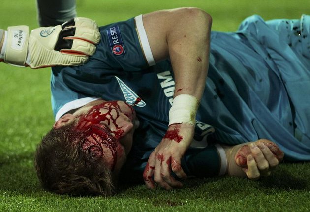 Zakrvácený slovenský stoper Tomáš Hubočan po srážce s kolenem Roberta Lewandowského.