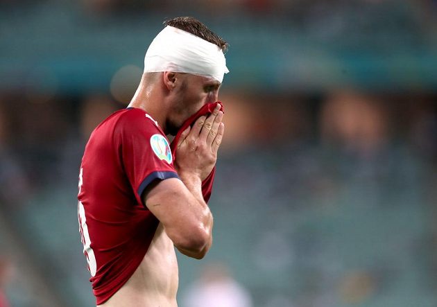 Tomáš Souček's bloody injury in the EURO quarterfinals did not get him from the midfielder's game.