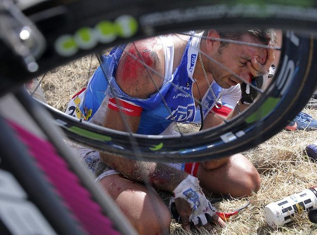 Sedřený francouzský cyklista William Bonnet trpí po pádu ve třetí etapě Tour de France.