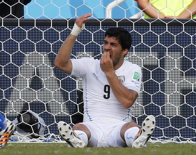 Luis Suárez se drží za zuby - italský zadák Chiellini má zřejmě velmi tvrdé kosti.
