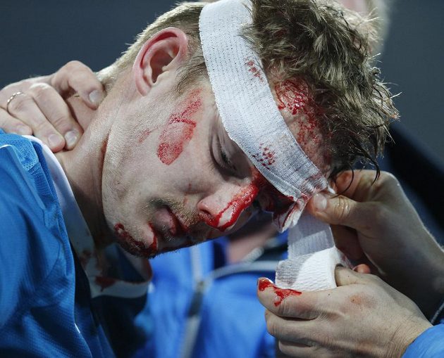 Obličej obránce Zenitu Tomáše Hubočana připomínal spíše boxera než fotbalistu.