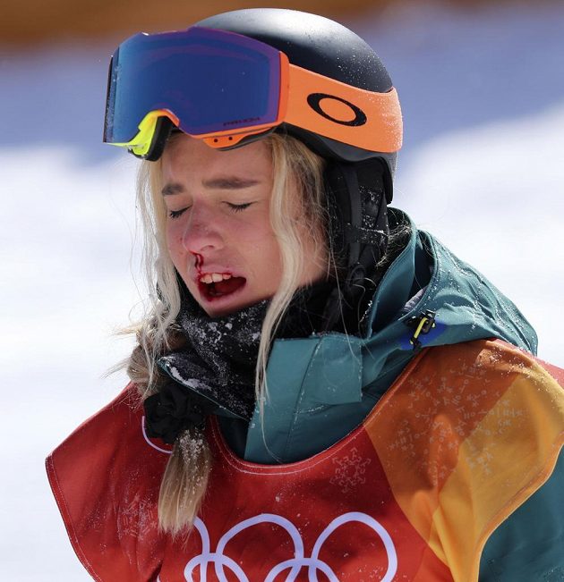 Australanka Emily Arthurová ve finále U-rampy na medaili nedosáhla, místo toho si natloukla a skončila s krvavým zraněním.