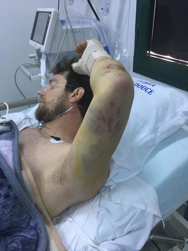 Jan Brabec bezprostředně po operaci.
