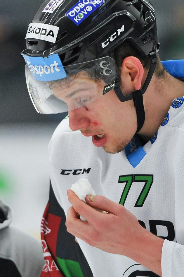 David Němeček z Mladé Boleslavi a jeho krvavý šrám ve tváři během 38. kola Tipsport extraligy.