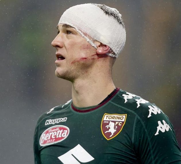 Takhle turínský brankář Joe Hart dopadl po faulu milánského Gianlucy Lapaduly...