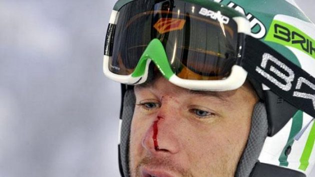 Americký lyžař Bode Miller s rozbitým nosem od jedné z branek na trati v Levi Americký lyžař Bode Miller s rozbitým nosem od jedné z branek na trati v Levi