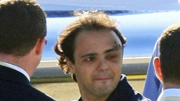 Brazilský pilot formule 1 Felipe Massa po propuštění z nemocnice v Budapešti, kde strávil devět dnů po zranění hlavy při Velké ceně Maďarska. Brazilský pilot formule 1 Felipe Massa po propuštění z nemocnice v Budapešti, kde strávil devět dnů po zranění hlavy při Velké ceně Maďarska.