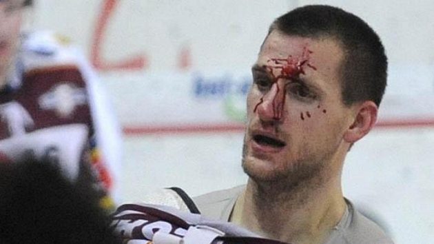 Martin Podlešák ze Sparty po bitce se slávistou Kůrkou Martin Podlešák ze Sparty po bitce se slávistou Kůrkou
