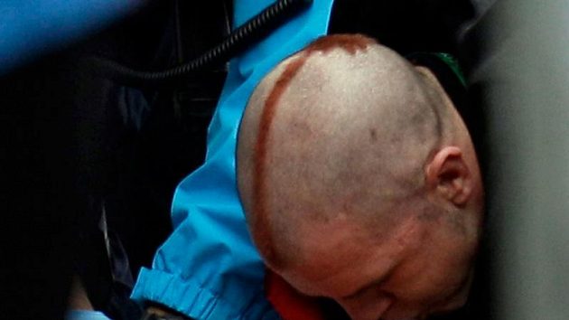 Gruzínský sáňkař Nodar Kumaritašvili v rukou lékařů, kterým se nepodařilo jej zachránit. Gruzínský sáňkař Nodar Kumaritašvili v rukou lékařů, kterým se nepodařilo jej zachránit.