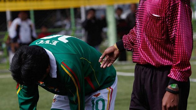 Evo Morales ukazuje svou nakopnutou holeň. Evo Morales ukazuje svou nakopnutou holeň.