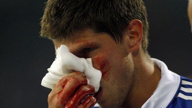 Klaas-Jan Huntelaar si drží zakrvácený nos po srážce se spoluhráčem. Klaas-Jan Huntelaar si drží zakrvácený nos po srážce se spoluhráčem.