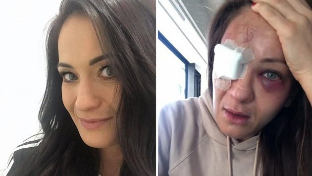 Karolina Kowalkiewiczová v civilu a po posledním zápase. Karolina Kowalkiewiczová v civilu a po posledním zápase.