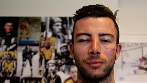 Jihlavský útočník Michal Hlinka po ataku skupiny výtržníků. Jihlavský útočník Michal Hlinka po ataku skupiny výtržníků.