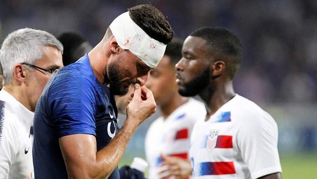 Francouz Olivier Giroud nedohrál zápas s USA kvůli tržné ráně na hlavě. Francouz Olivier Giroud nedohrál zápas s USA kvůli tržné ráně na hlavě.