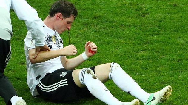 Pro krvácejícího Sebastiana Rudyho zápas se Švédy už po půlhodině skončil. Pro krvácejícího Sebastiana Rudyho zápas se Švédy už po půlhodině skončil.