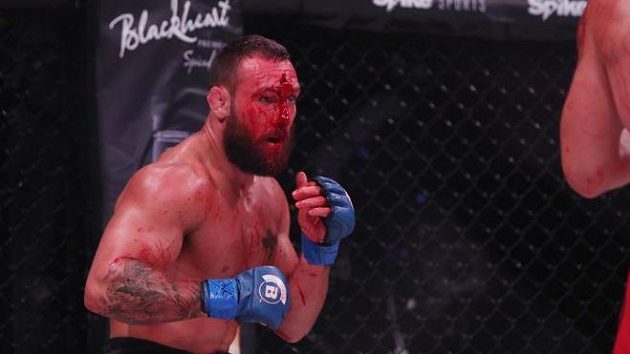 Brandon Girtz odešel ze zápasu s velkou památkou na čele. Tu mu uštědřil Derek Campos při souboji na akci Bellator 181. Brandon Girtz odešel ze zápasu s velkou památkou na čele. Tu mu uštědřil Derek Campos při souboji na akci Bellator 181.