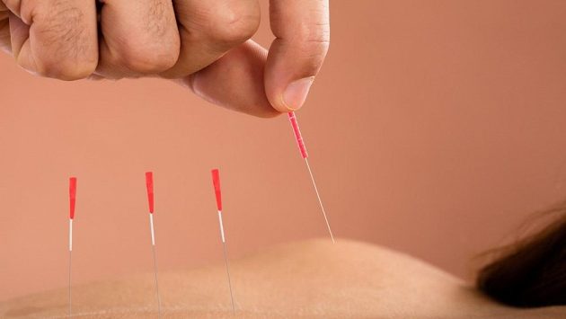 Tradiční čínská medicína má co říci i moderním běžcům. Tradiční čínská medicína má co říci i moderním běžcům.