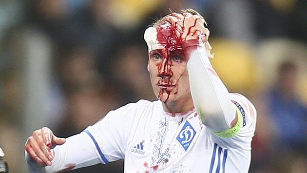Krev nešla zastavit. Domagoj Vida musel v duelu s Bernem střídat. Krev nešla zastavit. Domagoj Vida musel v duelu s Bernem střídat.