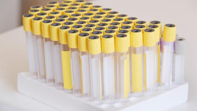 Doping, problém sportu. Doping, problém sportu.