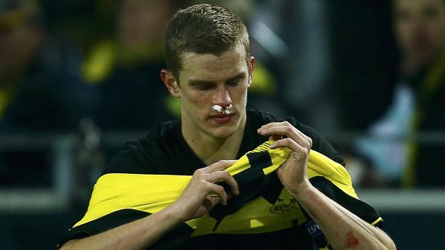 Sven Bender s krvavým nosem v utkání s Neapolí. Sven Bender s krvavým nosem v utkání s Neapolí.
