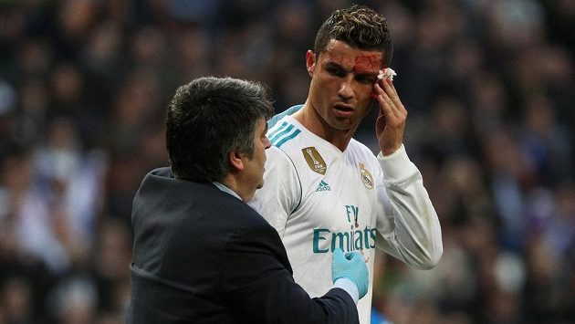 Cristiano Ronaldo z Realu utrpěl při utkání s La Coruňou krvavé zranění. Cristiano Ronaldo z Realu utrpěl při utkání s La Coruňou krvavé zranění.