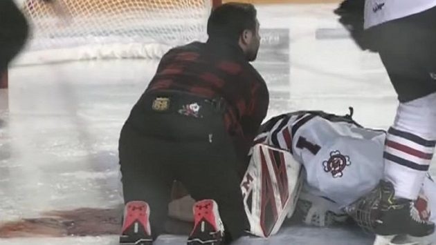 Tucker Tynan leží na ledě poté, co jej jeden z protihráčů zasáhl bruslí. Tucker Tynan leží na ledě poté, co jej jeden z protihráčů zasáhl bruslí.