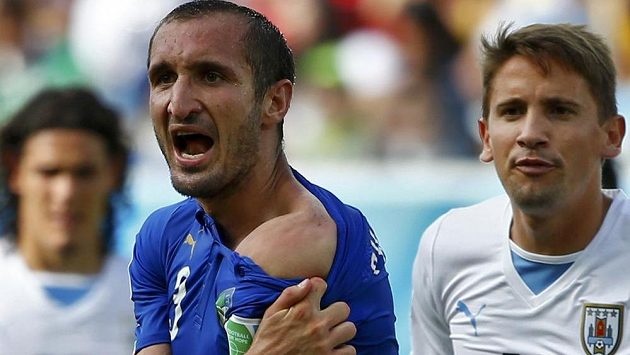 Italský zadák Giorgio Chiellini ukazuje sudímu rameno, do něhož ho o chvíli dříve kousl uruguayský snajpr Luis Suárez. Italský zadák Giorgio Chiellini ukazuje sudímu rameno, do něhož ho o chvíli dříve kousl uruguayský snajpr Luis Suárez.
