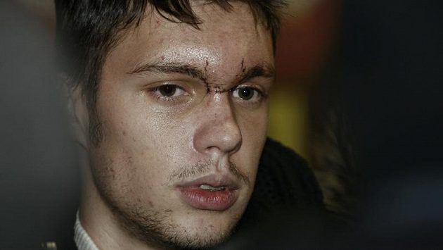 Václav Kadlec má poraněnou hlavu, přesto se přišel podívat na zápas Sparta - Brno. Václav Kadlec má poraněnou hlavu, přesto se přišel podívat na zápas Sparta - Brno.