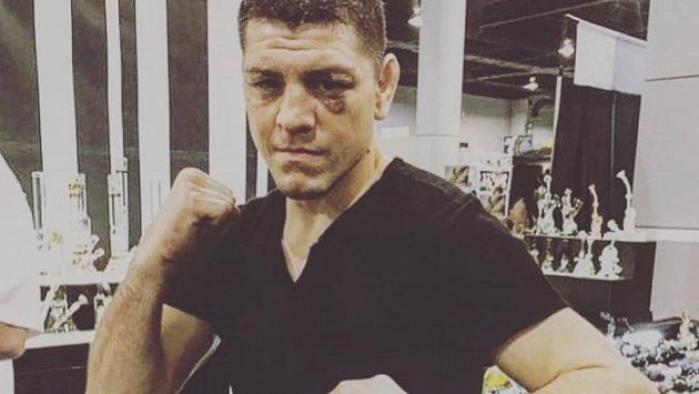 Nick Diaz mohl zápasit v Praze, nakonec nepřijel. Nick Diaz mohl zápasit v Praze, nakonec nepřijel.