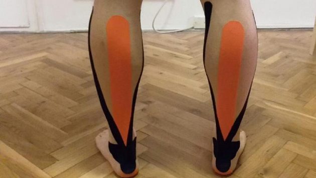 Tejpování lýtek, která při běhání měla problém. Trochu barev, světe div se, pomohlo to. Tejpování lýtek, která při běhání měla problém. Trochu barev, světe div se, pomohlo to.