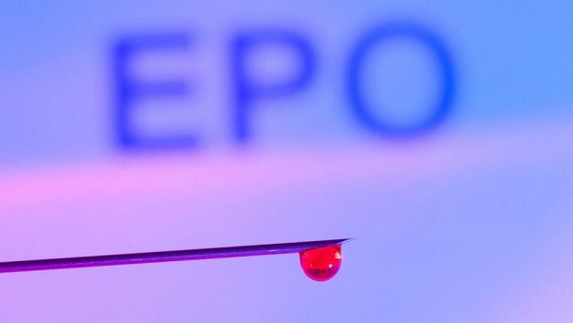 Když dobře trénujete, funguje doping méně. Co teď s tím? Když dobře trénujete, funguje doping méně. Co teď s tím?