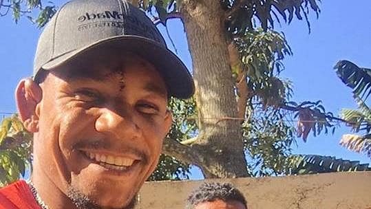Alex Oliveira už je v pohodě, ale 29 stehů na čele nejde přehlédnout. Alex Oliveira už je v pohodě, ale 29 stehů na čele nejde přehlédnout.