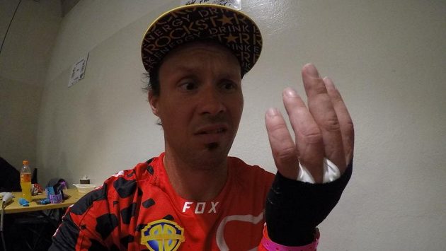 Freestyle motokrosař Libor Podmol závodil i se zlomeninou ruky. Freestyle motokrosař Libor Podmol závodil i se zlomeninou ruky.