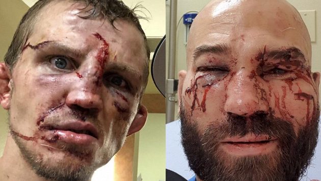 Následky bo bitvě v ringu. Artem Lobov a Jason Knight si to rozdali bez rukavic, jen pěstmi. Následky bo bitvě v ringu. Artem Lobov a Jason Knight si to rozdali bez rukavic, jen pěstmi.