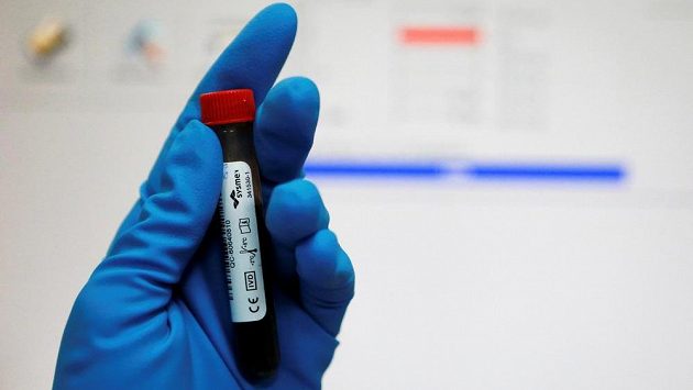 Pracovník ruské antidopingové laboratoře v Moskvě s krevním vzorkem - ilustrační foto. Pracovník ruské antidopingové laboratoře v Moskvě s krevním vzorkem - ilustrační foto.