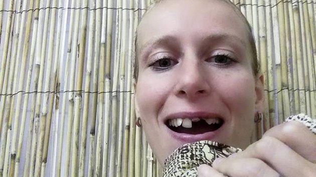 Squashistka Zuzana Kubáňová bude muset po turnaji v Čimicích k zubaři... Squashistka Zuzana Kubáňová bude muset po turnaji v Čimicích k zubaři...