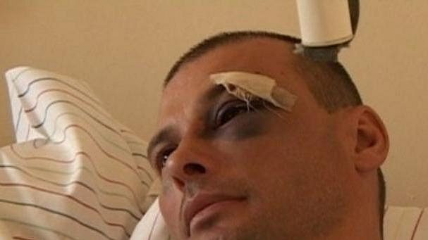 Sudí Roman Kret skončil po napadení v nemocnici. Sudí Roman Kret skončil po napadení v nemocnici.