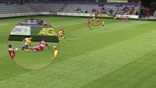 Mladého záložníka Mateje Trusu odvezli po zákroku soupeře ze hřiště rovnou na operační sál. Má zlomené dvě kosti a bez fotbalu bude možná až rok. Mladého záložníka Mateje Trusu odvezli po zákroku soupeře ze hřiště rovnou na operační sál. Má zlomené dvě kosti a bez fotbalu bude možná až rok.