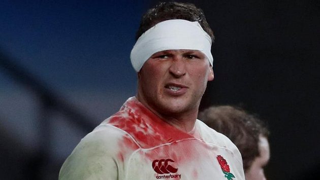 Stačí obvaz, hrajeme dál! Anglický kapitán Dylan Hartley během bitvy s Walesem. Stačí obvaz, hrajeme dál! Anglický kapitán Dylan Hartley během bitvy s Walesem.