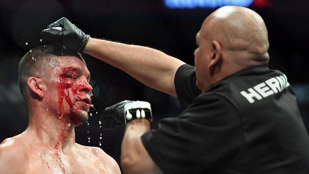 Nate Diaz a jeho obličej po duelu s Jorgem Masvidalem. Nate Diaz a jeho obličej po duelu s Jorgem Masvidalem.